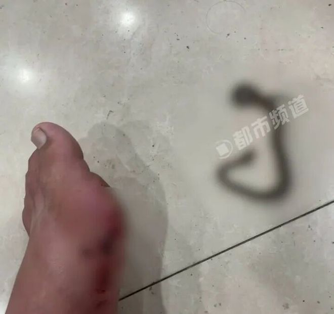 男子路边草丛方便被蛇咬下一秒抓蛇就医！ - 熊猫体育少儿体能培训